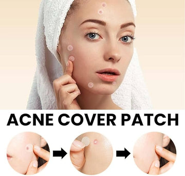 Acne Cover Patch (72pc)